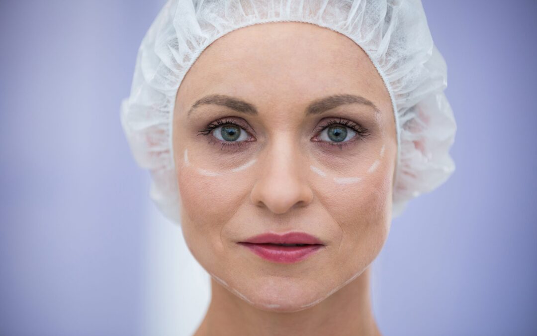¿Qué es y en qué consiste una blefaroplastia química?