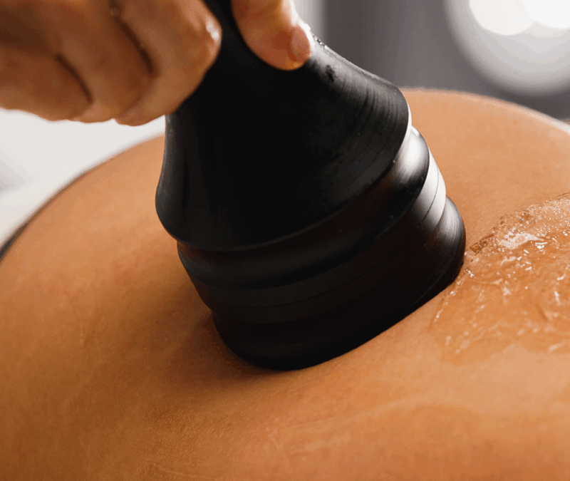 ¿Qué es la lipólisis láser y cómo funciona en la reducción de grasa localizada?