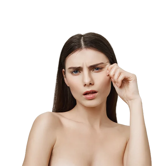 BLEFAROPLASTIA-full