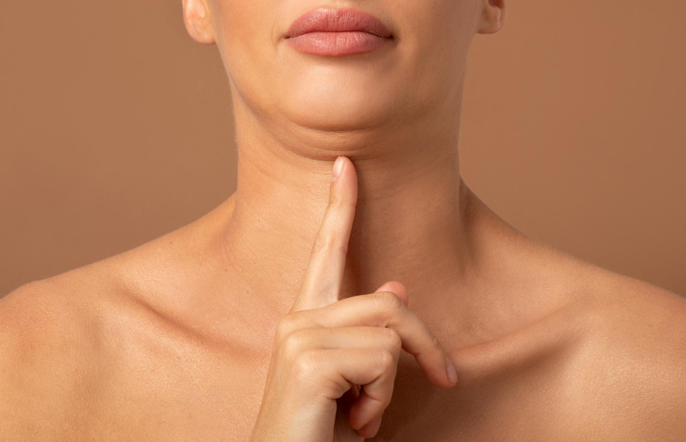 Reduccion_papada_002