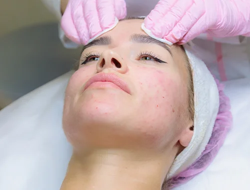 Qué tratamientos de rejuvenecimiento facial hay en Bogotá