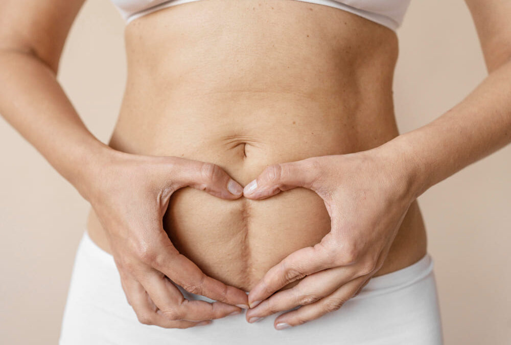 Borra cicatrices de tu piel con enzimas recombinantes